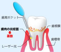 ポケット検査のイメージ